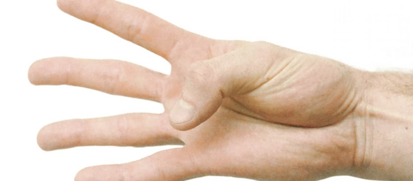 Σε εσάς φαίνεται αυτός ο μυς στα χέρια;